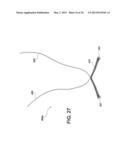 SOFT SUTURE-BASED ANCHORS diagram and image