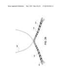 SOFT SUTURE-BASED ANCHORS diagram and image