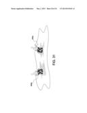 SOFT SUTURE-BASED ANCHORS diagram and image