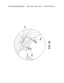 SOFT SUTURE-BASED ANCHORS diagram and image