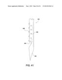 SOFT SUTURE-BASED ANCHORS diagram and image