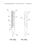 SOFT SUTURE-BASED ANCHORS diagram and image