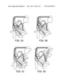 METHOD TO ASSESS HEMODYNAMIC PERFORMANCE DURING CARDIAC RESYNCHRONIZATION     THERAPY OPTIMIZATION USING ADMITTANCE WAVEFORMS AND DERIVATIVES diagram and image