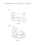 DEVICES FOR TRANSCATHETER PROSTHETIC HEART VALVE IMPLANTATION AND ACCESS     CLOSURE diagram and image