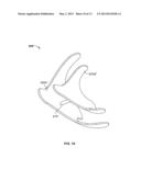 DEVICES FOR TRANSCATHETER PROSTHETIC HEART VALVE IMPLANTATION AND ACCESS     CLOSURE diagram and image