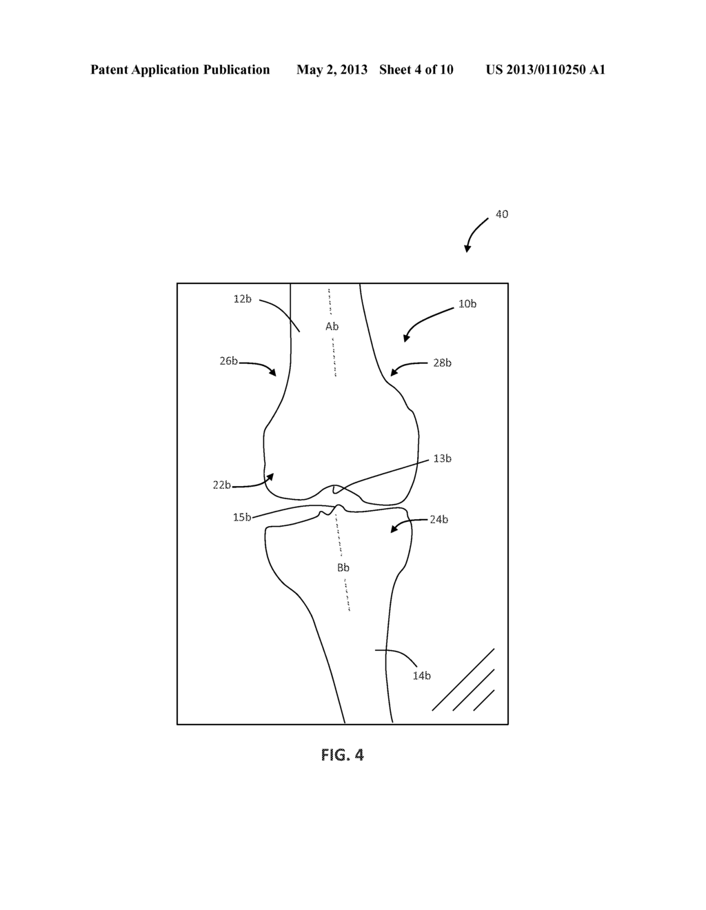 METHOD OF ESTIMATING SOFT TISSUE BALANCE FOR KNEE ARTHROPLASTY - diagram, schematic, and image 05