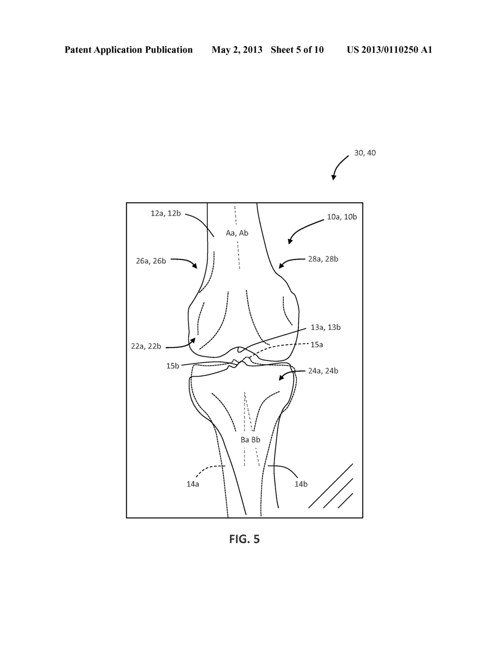 METHOD OF ESTIMATING SOFT TISSUE BALANCE FOR KNEE ARTHROPLASTY - diagram, schematic, and image 06