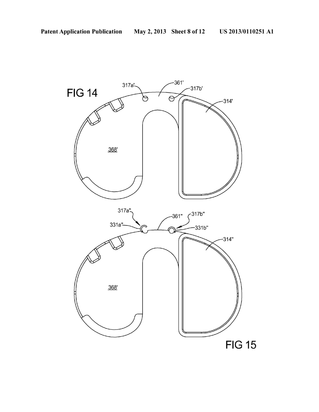 Knee Prosthesis Assembly With Ligament Link - diagram, schematic, and image 09