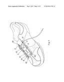 HIDDEN SHOELACE HOLE STRUCTURE diagram and image