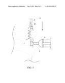 Disposable protective device for suction tube diagram and image