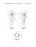 ENDOTRACHEAL TUBE WITH DUAL PORT SUBGLOTTIC SECRETION SUCTIONING diagram and image