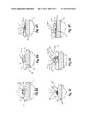 PIPELINE REINFORCEMENT ASSEMBLY AND METHOD diagram and image