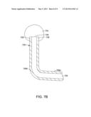 METHOD AND APPARATUS FOR FORMING A LAYERED METAL STRUCTURE WITH AN     ANODIZED SURFACE diagram and image