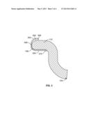 RIM FLANGE TRIM RING REPAIR SYSTEM diagram and image