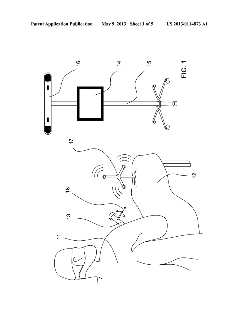 METHOD FOR AUTOMATICALLY IDENTIFYING THE CONTOURS OF A PREDEFINED BONE,     DERIVED METHODS AND CORRESPONDING COMPUTER PROGRAM PRODUCTS - diagram, schematic, and image 02