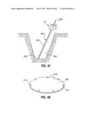 Pipe Stand diagram and image