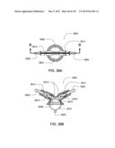 FLUID PUMPING SYSTEMS, DEVICES AND METHODS diagram and image