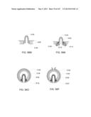 FLUID PUMPING SYSTEMS, DEVICES AND METHODS diagram and image