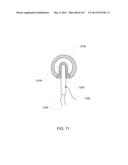 FLUID PUMPING SYSTEMS, DEVICES AND METHODS diagram and image