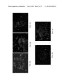 ISOLATED HIGH AFFINITY ENTITIES WITH T-CELL RECEPTOR LIKE SPECIFICITY     TOWARDS NATIVE COMPLEXES OF MHC CLASS II AND GLUTAMIC ACID DECARBOXYLASE     (GAD) AUTOANTIGENIC PEPTIDES diagram and image