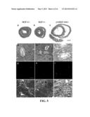 METHODS OF LIMITING MICROVASCULAR DAMAGE FOLLOWING ACUTE MYOCARDIAL     ISCHEMIA diagram and image