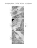 METHODS OF LIMITING MICROVASCULAR DAMAGE FOLLOWING ACUTE MYOCARDIAL     ISCHEMIA diagram and image