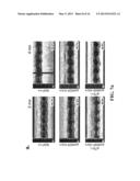 METHODS OF LIMITING MICROVASCULAR DAMAGE FOLLOWING ACUTE MYOCARDIAL     ISCHEMIA diagram and image