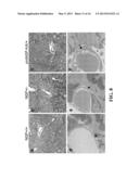 METHODS OF LIMITING MICROVASCULAR DAMAGE FOLLOWING ACUTE MYOCARDIAL     ISCHEMIA diagram and image