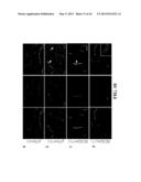 METHODS OF LIMITING MICROVASCULAR DAMAGE FOLLOWING ACUTE MYOCARDIAL     ISCHEMIA diagram and image