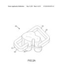 ARTHROPLASTY SYSTEMS AND DEVICES, AND RELATED METHODS diagram and image