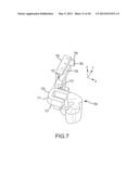 ARTHROPLASTY SYSTEMS AND DEVICES, AND RELATED METHODS diagram and image