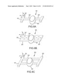 ARTHROPLASTY SYSTEMS AND DEVICES, AND RELATED METHODS diagram and image