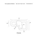 ARTHROPLASTY SYSTEMS AND DEVICES, AND RELATED METHODS diagram and image