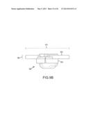 ARTHROPLASTY SYSTEMS AND DEVICES, AND RELATED METHODS diagram and image