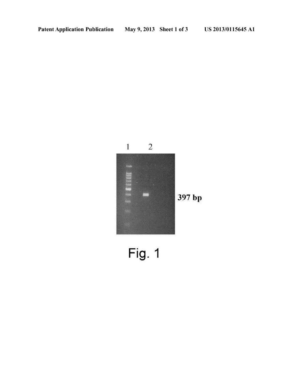 FGL-2 PROTHROMBINASE AS A DIAGNOSTIC TOOL FOR MALIGNANCY - diagram, schematic, and image 02