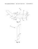 I-BEAM CONSTRUCTION IN A HOCKEY BLADE CORE diagram and image