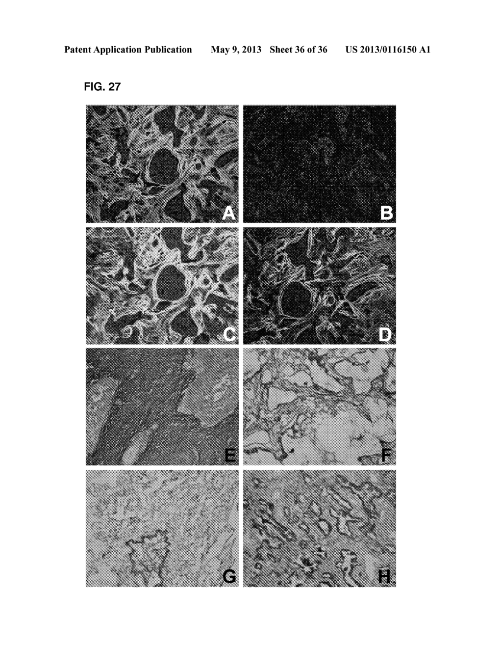 Lung Cancer Biomarkers and Uses Thereof - diagram, schematic, and image 37