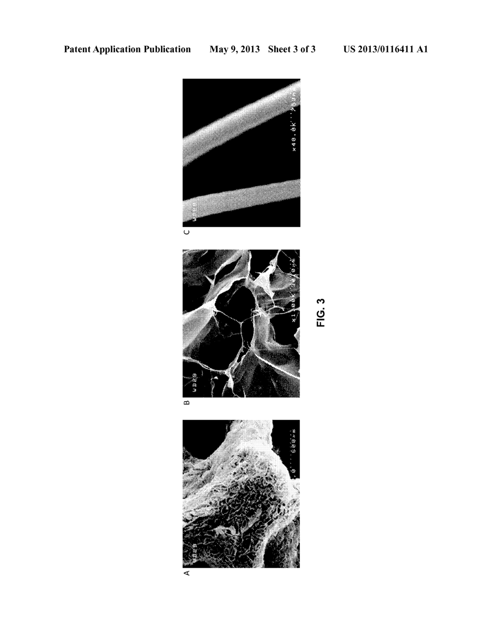 METHODS OF MAKING HYALURONIC ACID/COLLAGEN COMPOSITIONS - diagram, schematic, and image 04