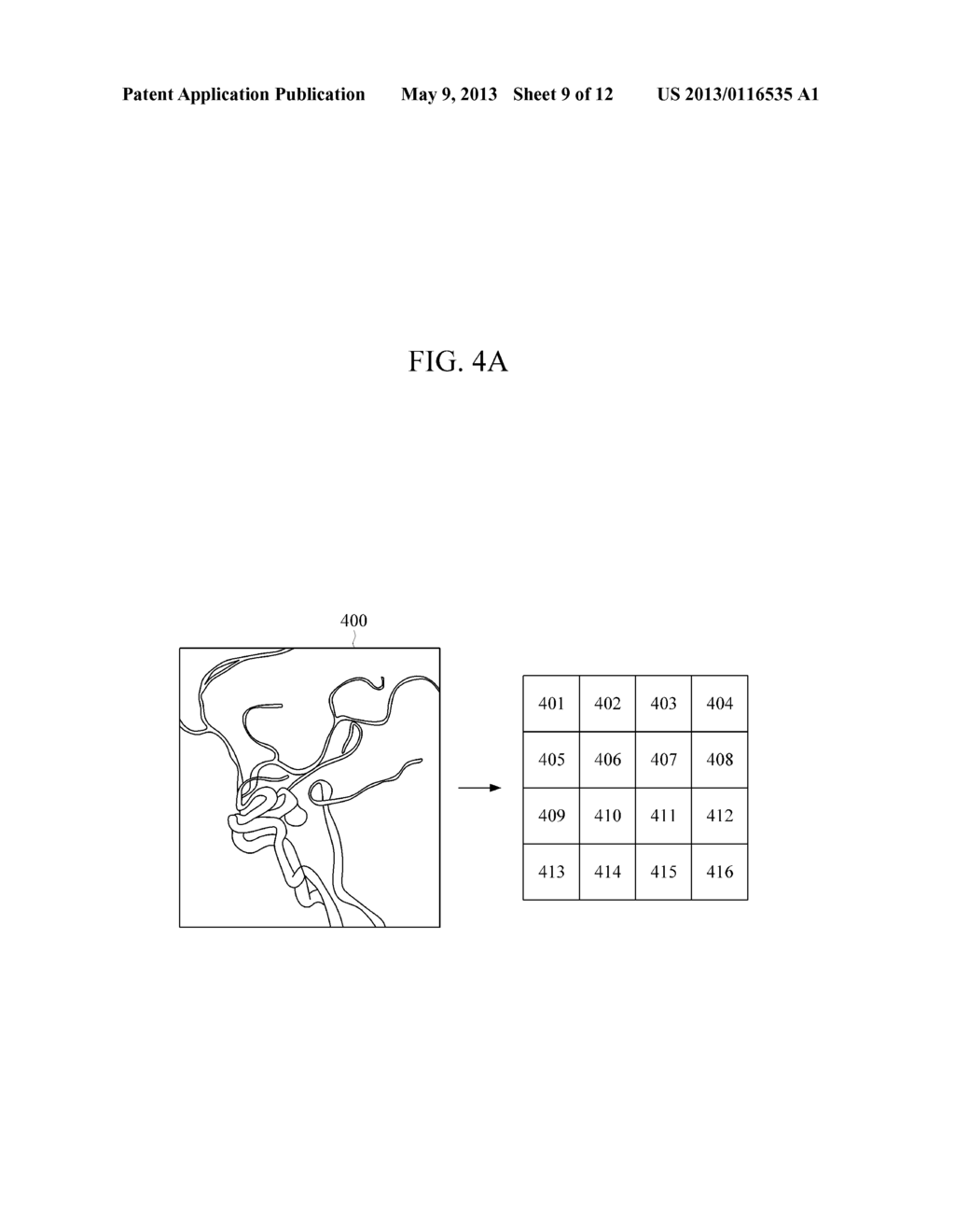 APPARATUS AND METHOD FOR DIAGNOSING A LESION - diagram, schematic, and image 10