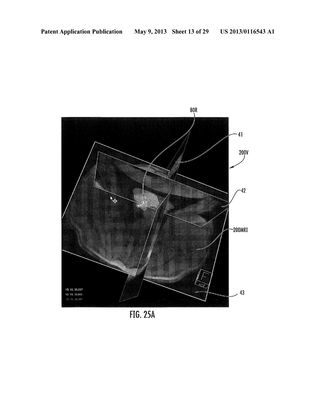 MRI-GUIDED DEVICES AND MRI-GUIDED INTERVENTIONAL SYSTEMS THAT CAN TRACK     AND GENERATE DYNAMIC VISUALIZATIONS OF THE DEVICES IN NEAR REAL TIME - diagram, schematic, and image 14