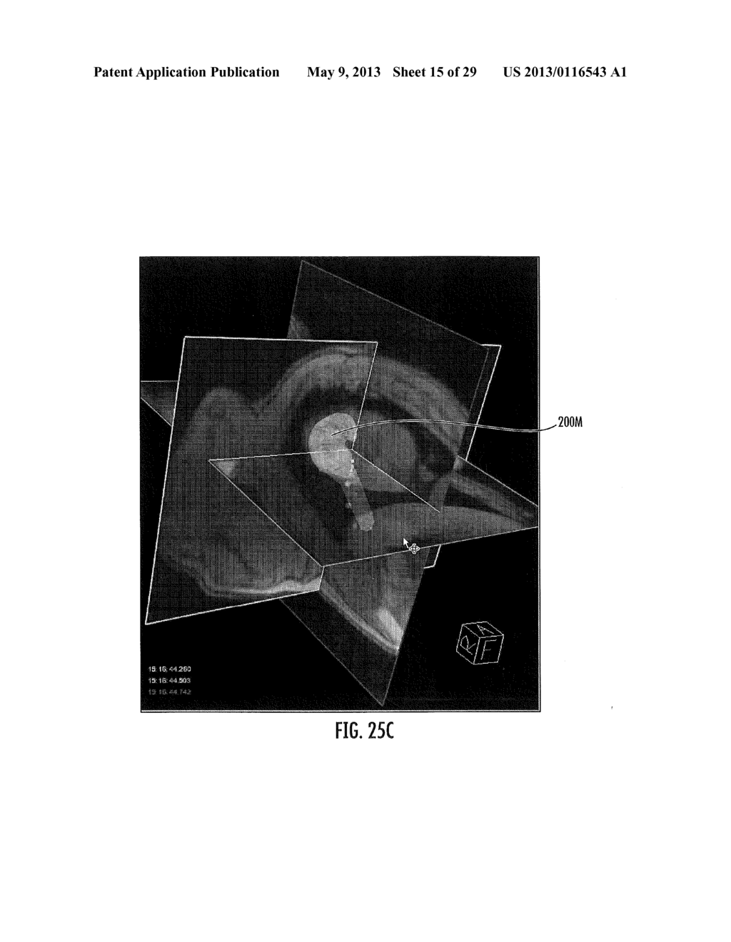 MRI-GUIDED DEVICES AND MRI-GUIDED INTERVENTIONAL SYSTEMS THAT CAN TRACK     AND GENERATE DYNAMIC VISUALIZATIONS OF THE DEVICES IN NEAR REAL TIME - diagram, schematic, and image 16