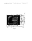 MRI-GUIDED DEVICES AND MRI-GUIDED INTERVENTIONAL SYSTEMS THAT CAN TRACK     AND GENERATE DYNAMIC VISUALIZATIONS OF THE DEVICES IN NEAR REAL TIME diagram and image