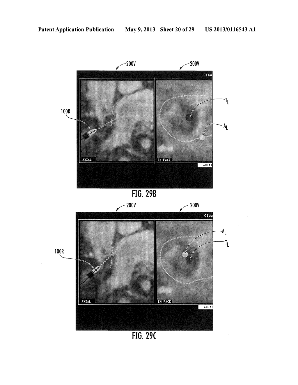 MRI-GUIDED DEVICES AND MRI-GUIDED INTERVENTIONAL SYSTEMS THAT CAN TRACK     AND GENERATE DYNAMIC VISUALIZATIONS OF THE DEVICES IN NEAR REAL TIME - diagram, schematic, and image 21