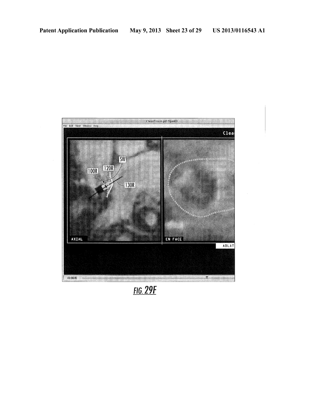 MRI-GUIDED DEVICES AND MRI-GUIDED INTERVENTIONAL SYSTEMS THAT CAN TRACK     AND GENERATE DYNAMIC VISUALIZATIONS OF THE DEVICES IN NEAR REAL TIME - diagram, schematic, and image 24