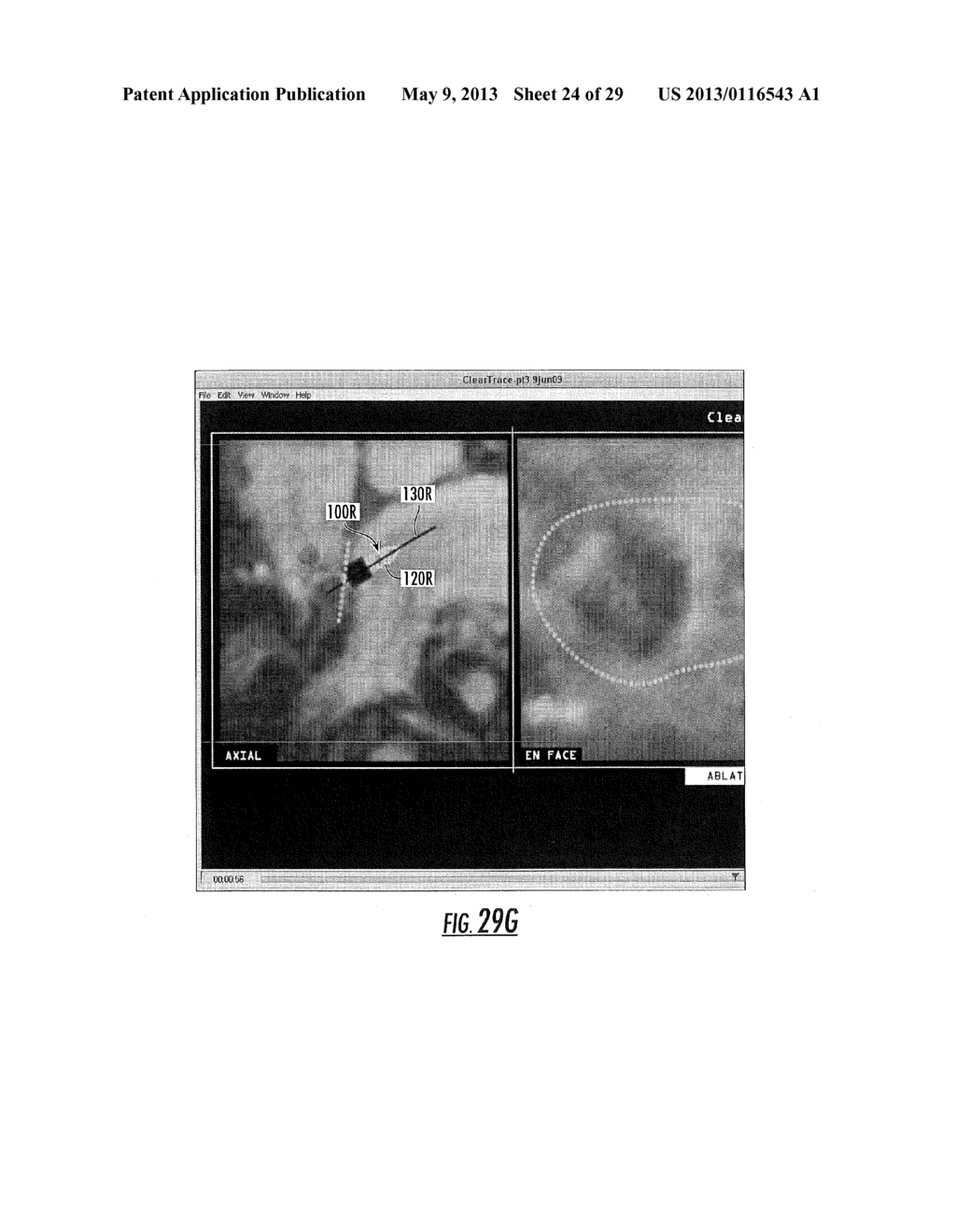 MRI-GUIDED DEVICES AND MRI-GUIDED INTERVENTIONAL SYSTEMS THAT CAN TRACK     AND GENERATE DYNAMIC VISUALIZATIONS OF THE DEVICES IN NEAR REAL TIME - diagram, schematic, and image 25