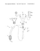 Anchored Working Channel diagram and image