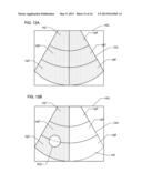 ULTRASOUND DIAGNOSTIC APPARATUS AND METHOD OF DETERMINING A TIME INTENSITY     CURVE diagram and image