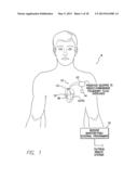 SYSTEMS AND METHODS FOR PREDICTING AND CORROBORATING PULMONARY FLUID     OVERLOADS USING AN IMPLANTABLE MEDICAL DEVICE diagram and image