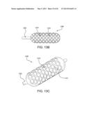 BALLOON ASSEMBLIES HAVING CONTROLLABLY VARIABLE TOPOGRAPHIES diagram and image