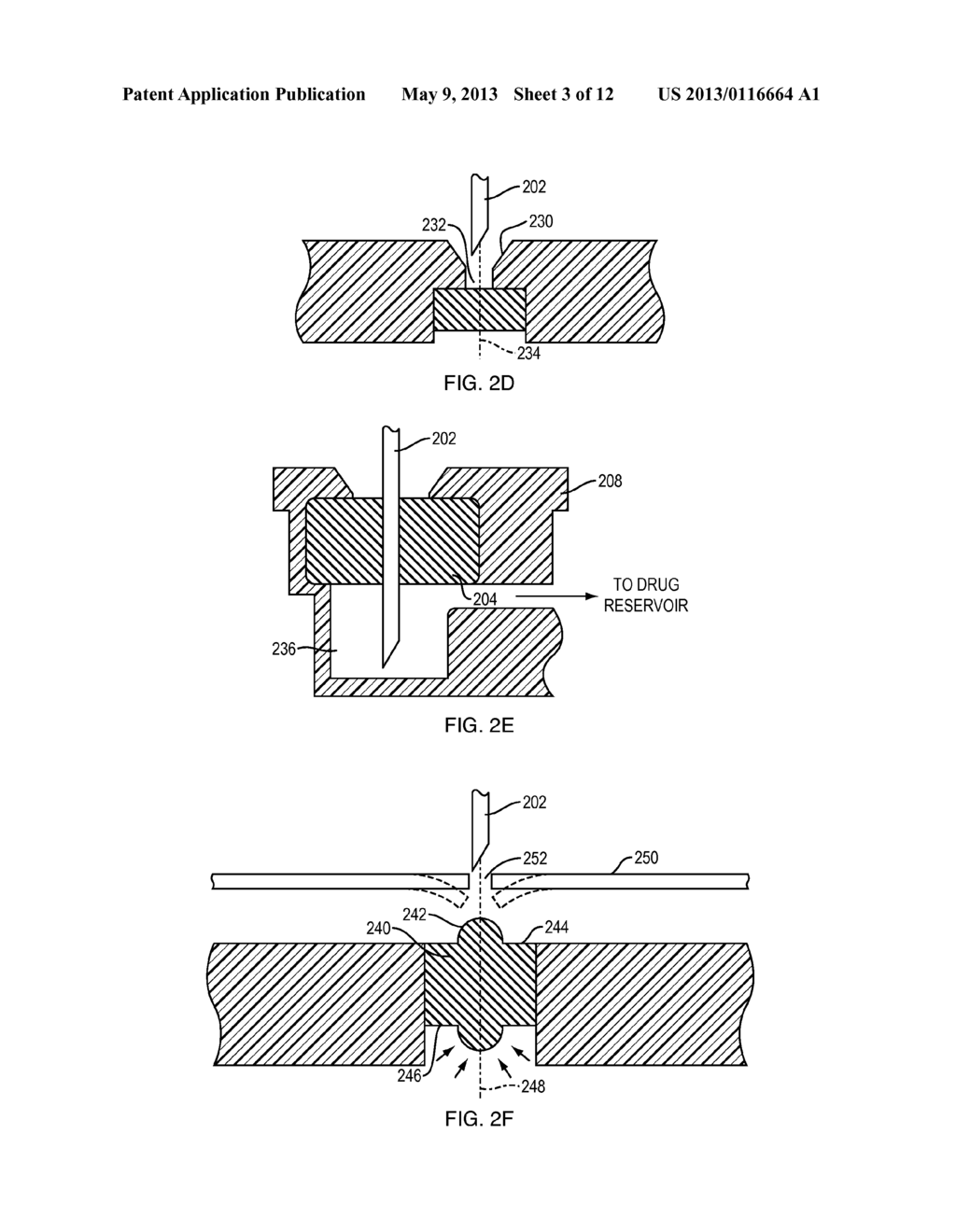 IMPLANTABLE DRUG PUMPS AND REFILL DEVICES THEREFOR - diagram, schematic, and image 04